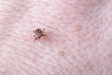 Adult female tick - Ixodes ricinus.A predatory parasitic tick crawls along the human body.Carrier of infectious diseases as encephalitis or Lyme borreliosis.