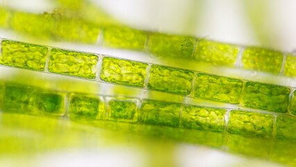 Freshwater filamentous green algae, Microspora sp. Live cell. 400x magnification + 2.6x camera...