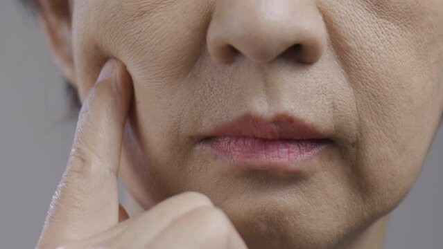 Flabby and wrinkled skin on senior woman face.