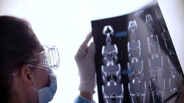 Doctor using tomography scan to diagnose patient's condition	