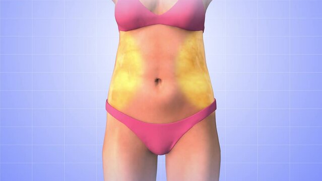 Stubborn fat reduction medical animation