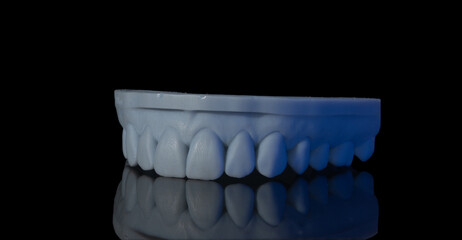 3D Printed Model, Innovation in the Dental Laboratory.