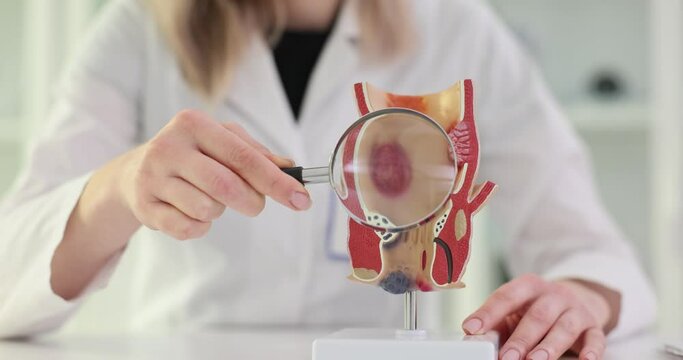 Anatomical model of a diseased colon and a magnifying glass in hands of a doctor