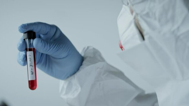 Person holding a vial of blood tested positive for covid-19 in a medical lab