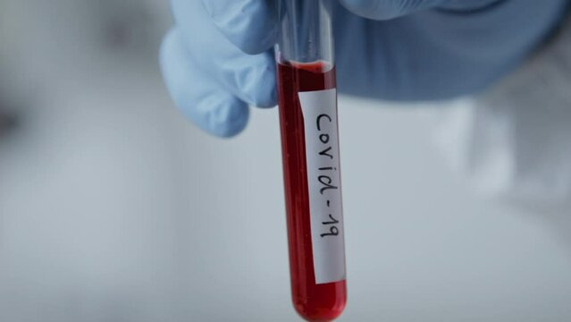 Vial of blood tested positive for covid-19