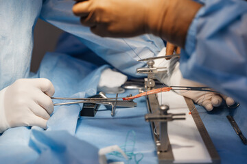 surgeons work on the cut part of the knee joint (muscular ligament). Arthroscopic anterior cruciate...