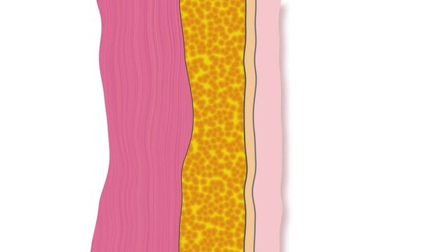 Cross section show fat burning under the skin. Effect of the drug against fat and cellulite.
