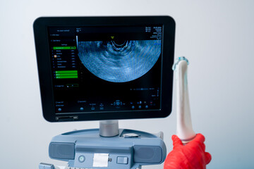 close-up in the clinic gynecological office the doctor holds the ultrasound machine ready