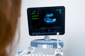 close up In a gynecological office in a clinic doctor conducts an ultrasound of a patient s small...