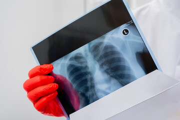 close up in a private clinic in white x-ray room the doctor shows the patient a picture of the back