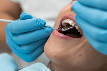 The dentist works in a cozy dental office, providing effective dental care, and the patient in the...