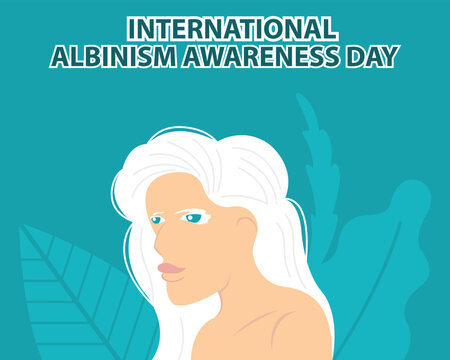 illustration vector graphic of a woman with white hair, perfect for international day, albinism awareness day, celebrate, greeting card, etc.
