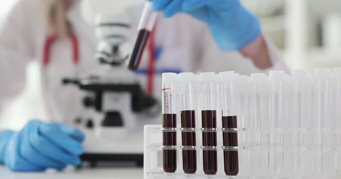 Analysis of blood samples and medical diagnosis of disease
