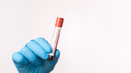 Doping Test of Olympic Games Athletes. Test tube with doping test of athlete's blood on white...