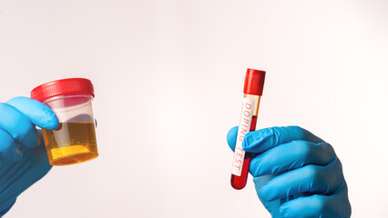 Doping Test of Olympic Games Athletes. Test tube with doping test of athlete's blood on white...