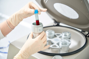 Nurse preparing blood sample for plasma separation in special centrifuge