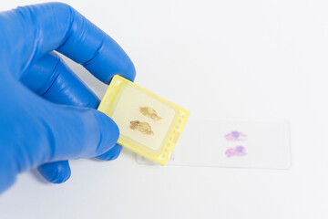 Scientist wear blue glove holding paraffin human tissue block and out of focus slide on white...