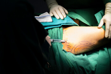 Female patient with marks on skin lying on medical bed while doctor preparing tools.Plastic surgeon...