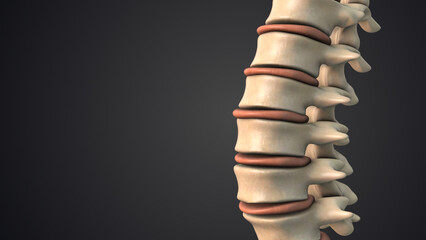 Difficulties with the human spinal discs