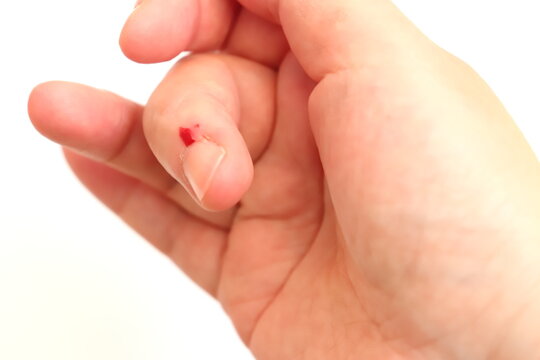 ささくれで血が吹き出した指