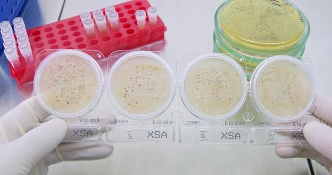Scientist conducts experiment with bacterium living in different environments in laboratory closeup. Medical researching of microorganisms
