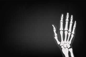 Anatomy and body part: X-ray hand of human 