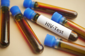 HIV blood test tube on color background 