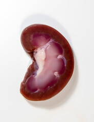 Close-up with a real sectioned kidney