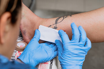 Domestic nurse in blue gloves healing a woman with a broken foot leaning on a small white chair. Tattooed foot with surgical stitches.