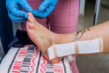 Domestic nurse in blue gloves healing a woman with a broken foot leaning on a small white chair....