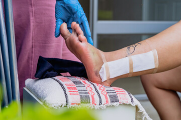 Domestic nurse in blue gloves healing a woman with a broken foot leaning on a small white chair. Tattooed foot with surgical stitches.