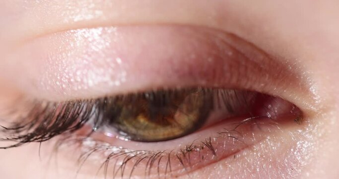 Brown eye blinking closeup. Farsightedness and myopia and vision testing