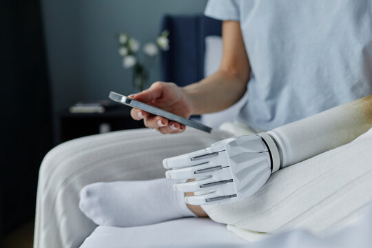 Young woman with bionic arm using mobile phone sitting on bed at home