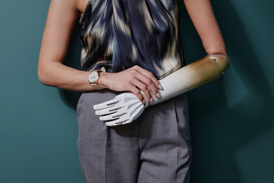 Young woman with bionic arm standing in front of on green wall