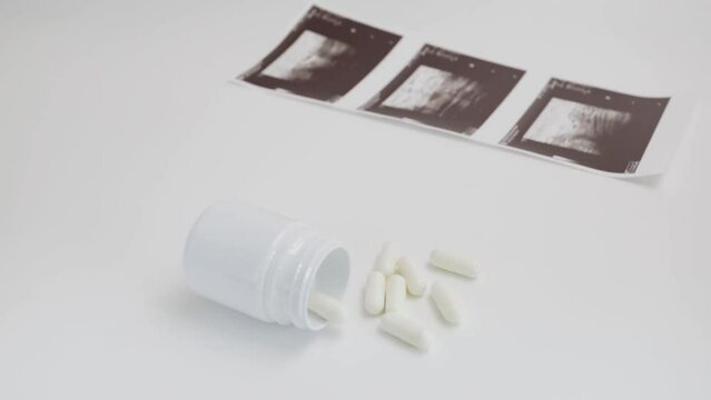 Abortion pills, oral contraception, pharmacy shelf, choices for women's health