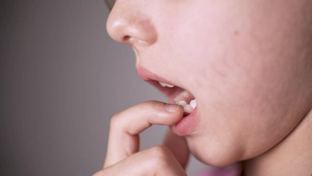 Little girl shaking tongue milk tooth in mouth, close-up