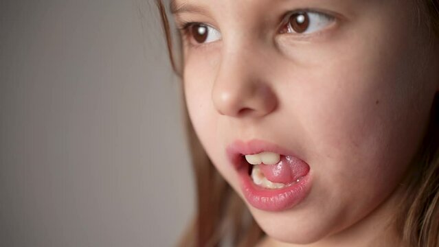 Little girl shaking tongue milk tooth in mouth, close-up