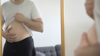 Weightloss concept. Overweight male touches belly in front of mirror