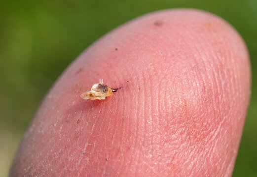 A bee stung a mans finger. 