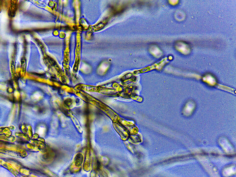 photo of fungi spores and mycelium under the microscope