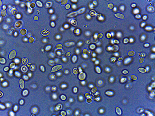 Microscopic View of Fungi with Hyphae and Spores