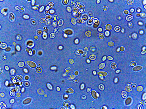 photo of fungi spores and mycelium under the microscope