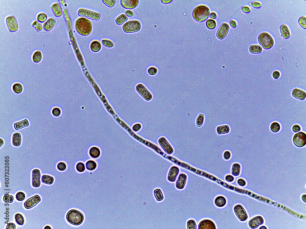 Wall mural photo of fungi spores and mycelium under the microscope