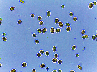 Microscopic View of Fungi with Hyphae and Spores