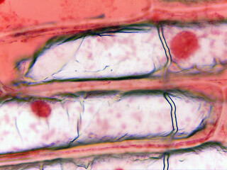 photo of epidermal cells exist in a single layer under the microscope