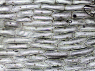 photo of epidermal cells exist in a single layer under the microscope