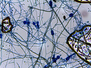 Microscopic View of Fungi with Hyphae and Spores