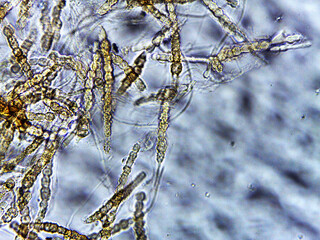 Microscopic Structures of Fungi for Mycology Study