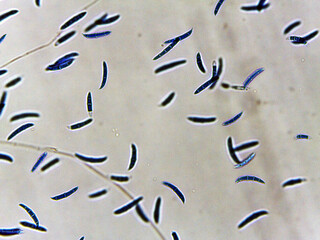 photo of fungi mold mycelium growth and spores under the microscope