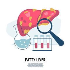 Fatty liver or hepatic steatosis disease poster, flat vector illustration isolated on white background. Nonalcoholic Fatty Liver Disease damage or NAFLD condition for healthcare concept.